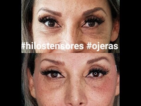 Terapias Revitalizantes para Combatir el Envejecimiento